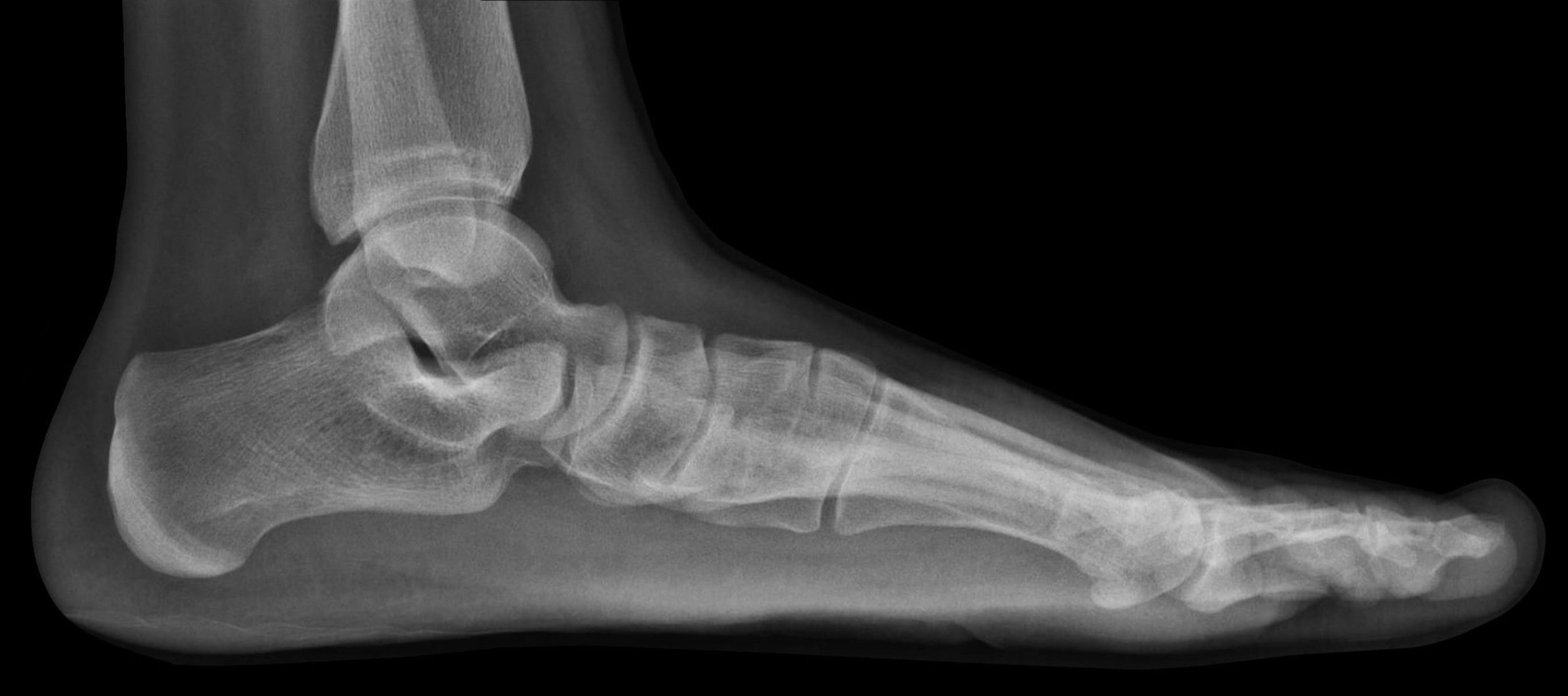 poor posture postureawarenessmonth intro