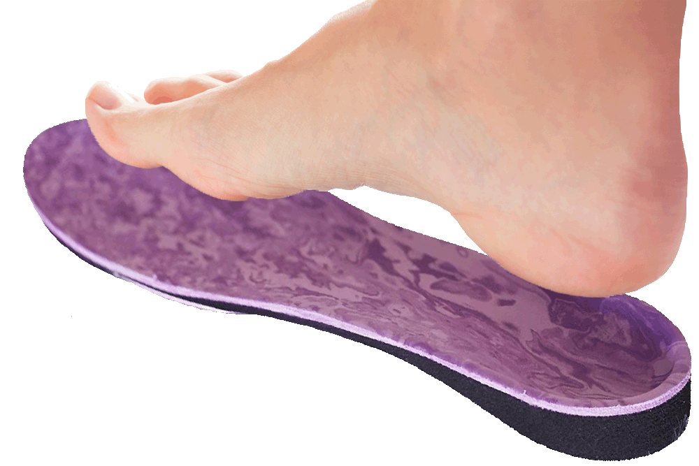 pronation foot and orthotic